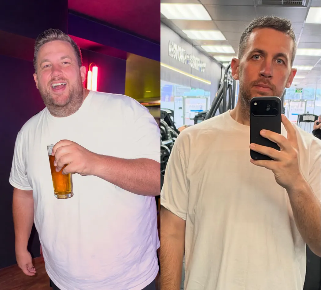Before and after image of Hims weight loss member Burgo