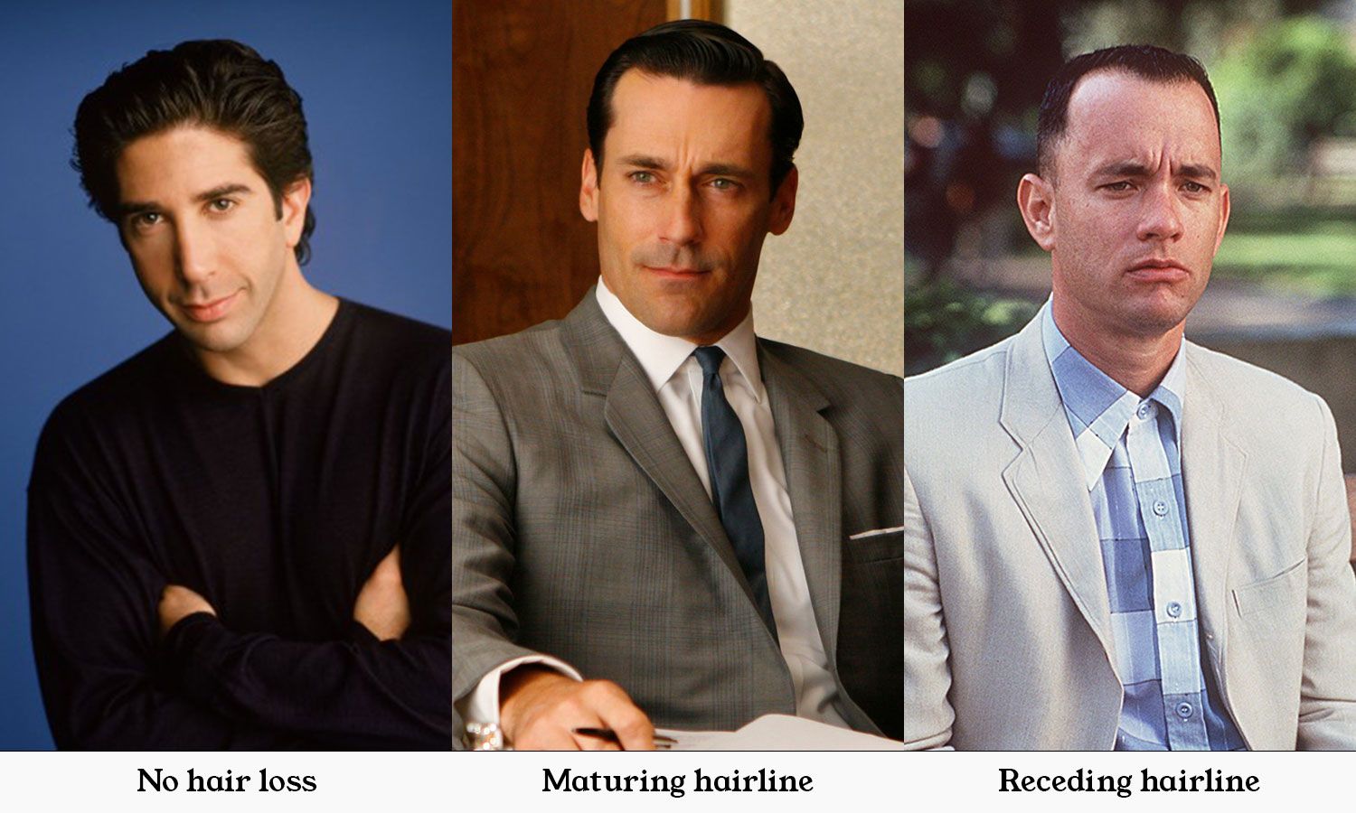 Side-by-side comparison of no hair loss, a maturing hairline and a receding hairline on three men