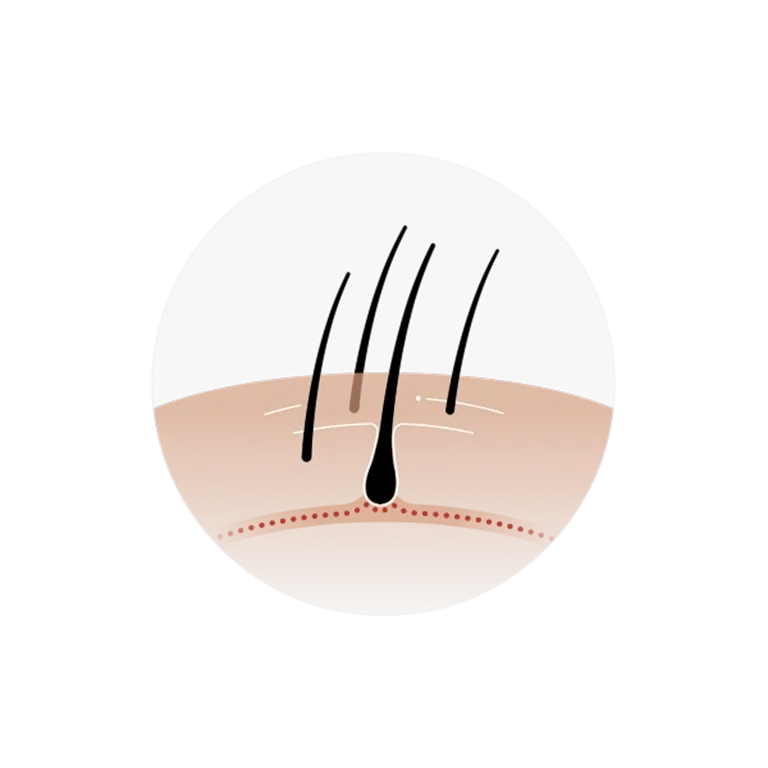 New growth appearing after hair loss treatment plan takes action