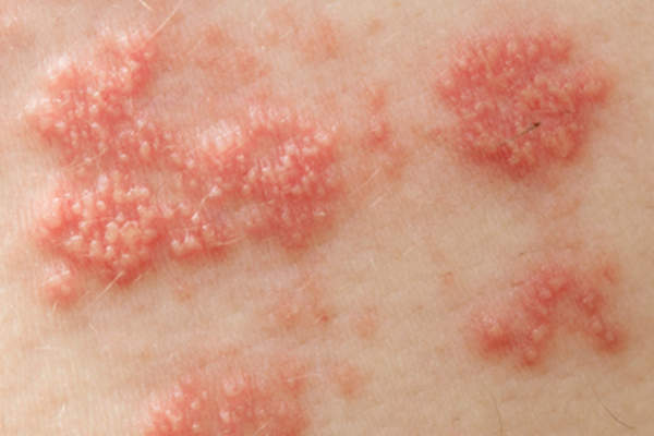 背部木瓦的特写。