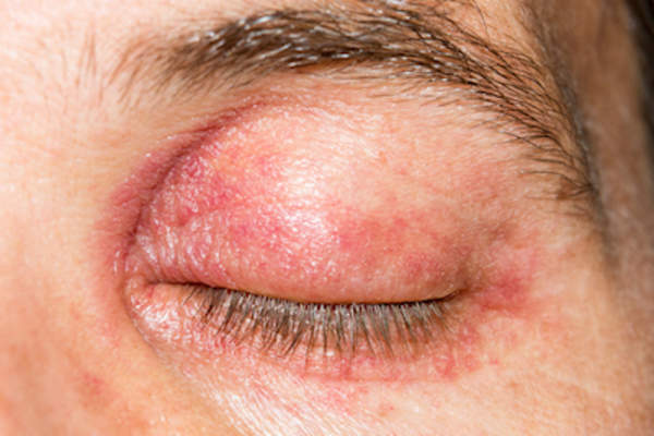 闭上红肿的眼睛。