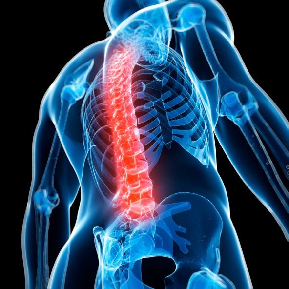 10 Facts About Ankylosing Spondylitis HealthCentral