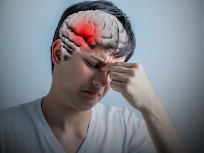 偏头痛的概念强调大脑。