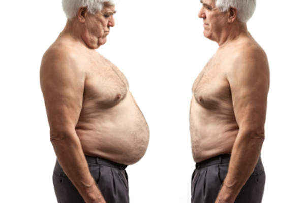 患有消化系统疾病的老人。