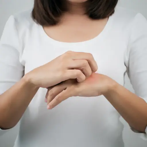 一个女人在她的手上抓痒和发痒的湿疹。