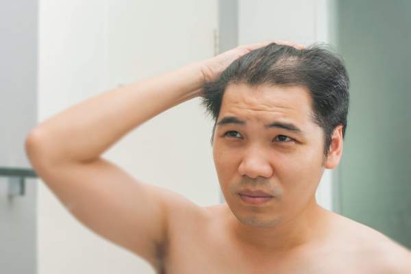 不幸的人注意到脱发镜子。