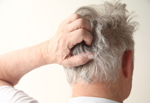 Dos and Don'ts for Scalp Psoriasis