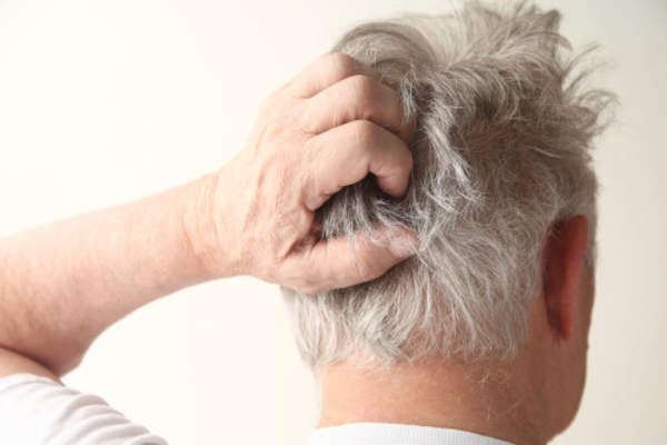 Do S And Don Ts For Scalp Psoriasis