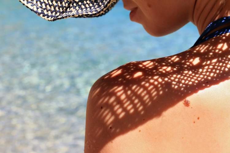 女人在阳光下与她的肩膀摩尔