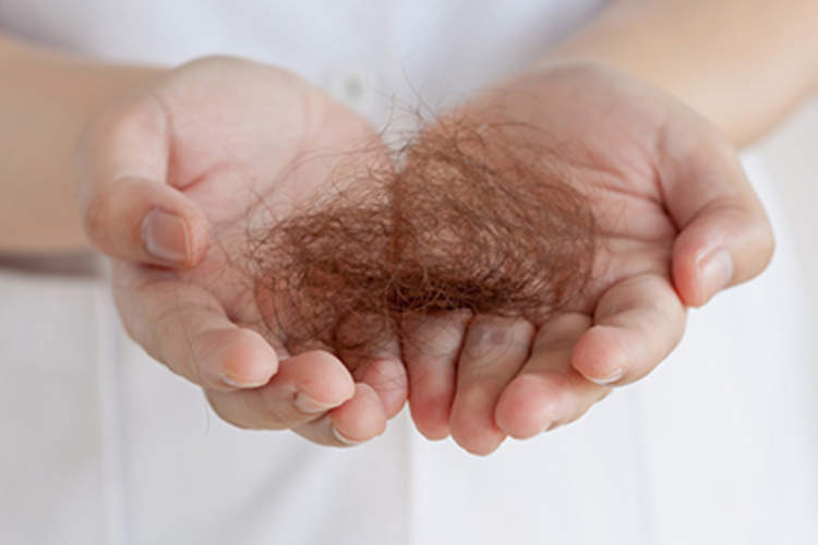 How To Stop Hair Loss During Menopause
