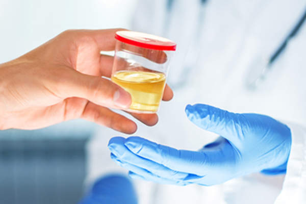 病人把尿样交给医生。