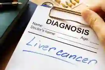 诊断肝癌