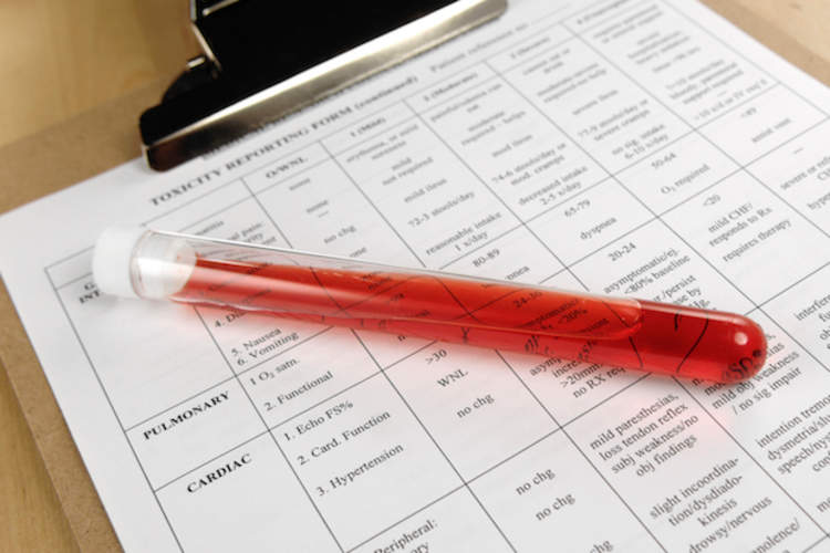 新的建议关于PSA测试