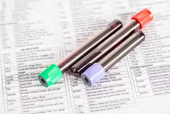 在医学考试表格上的管中的血液样本