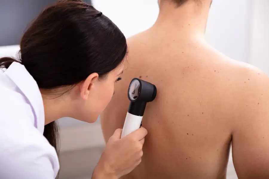9 Sneaky Warning Signs of Melanoma You Might Miss