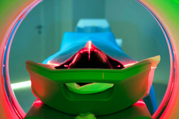 具有病人头部和颈部CT扫描。