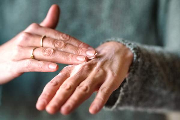 女人把药膏在手中