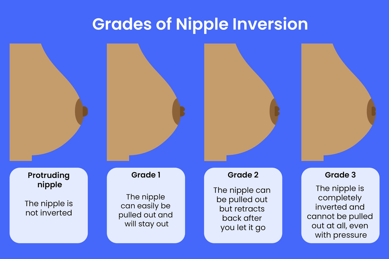 Nurture For Two - Nipples like breasts come in all shapes and sizes. Nipples  change during pregnancy. They become larger and more elastic. Your nipples  may appear flat or inverted at the