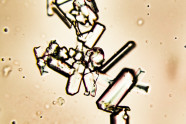 Uric Acid Crystals How They Form And Affect The Joints