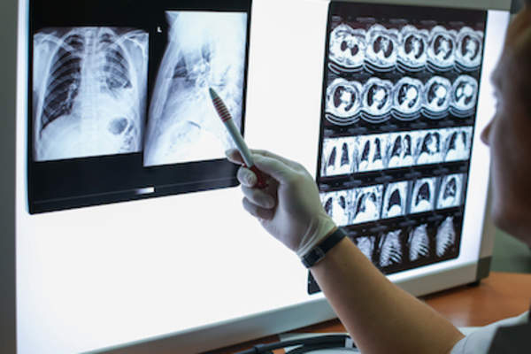 放射科医生观察CT扫描。