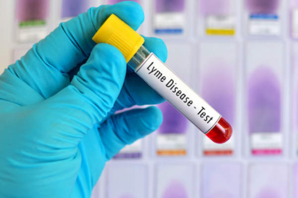 莱姆病验血小瓶。
