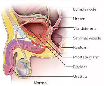 正常Prostate-1