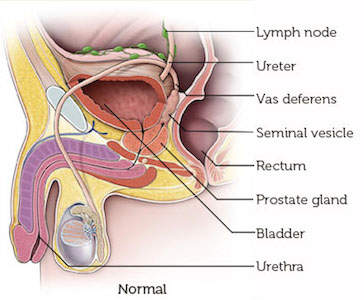 正常Prostate-1