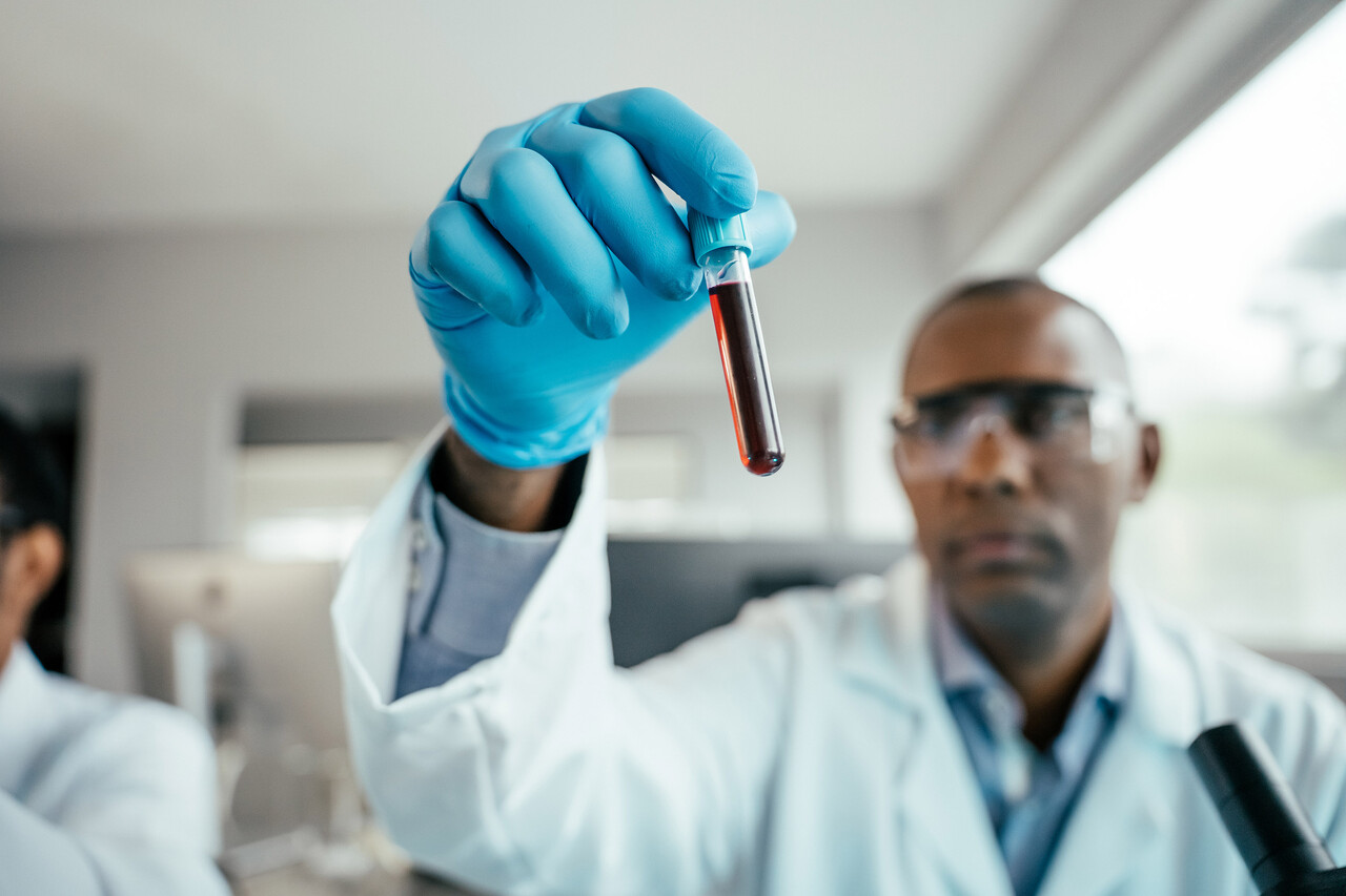 Hidden Immune War Reveals RA Begins Years Before Symptoms