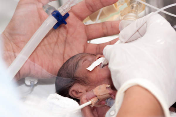 住院的早产儿。