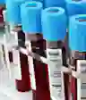 血液试管