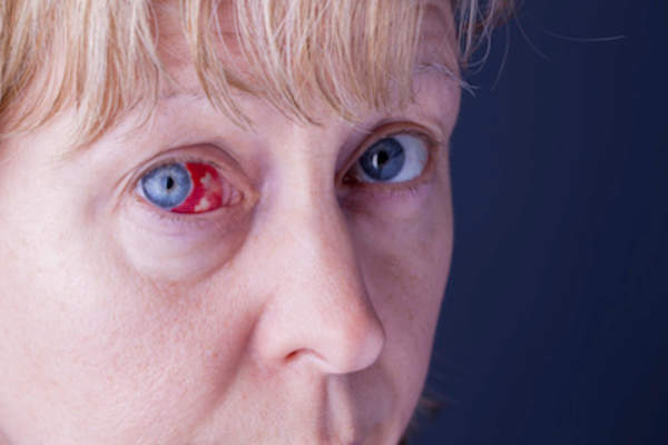 一只眼睛想了解