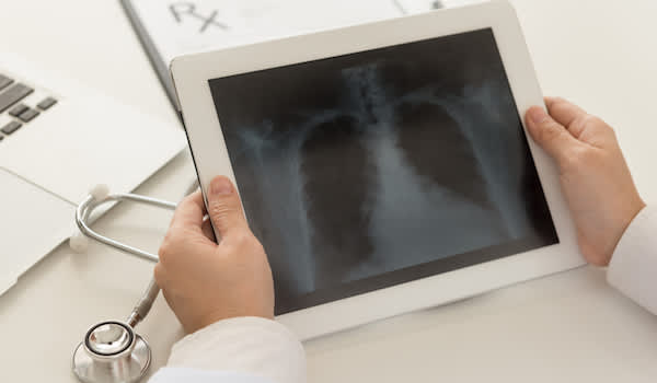 医生平板电脑观看肺扫描。