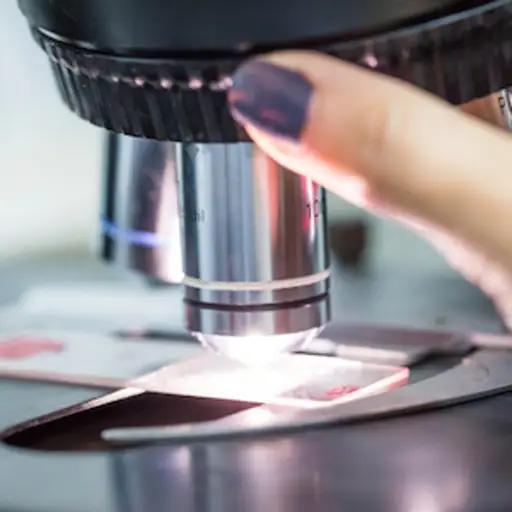 Lab tech examining tumor biopsy under microscope.