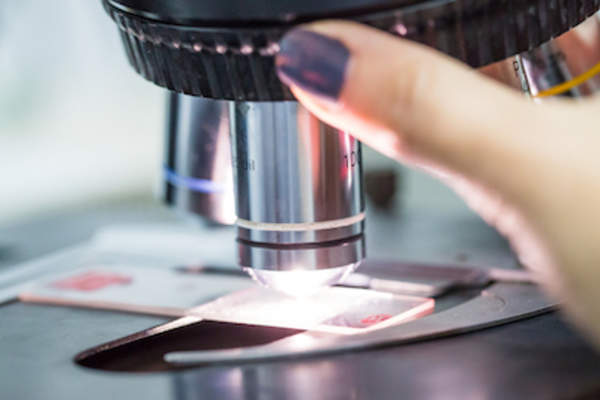 在显微镜下检查肿瘤活检的实验室技术。