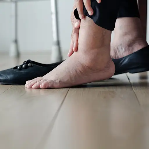 蛋白尿