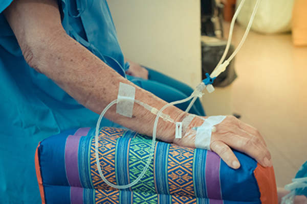 癌症患者接受化疗治疗。