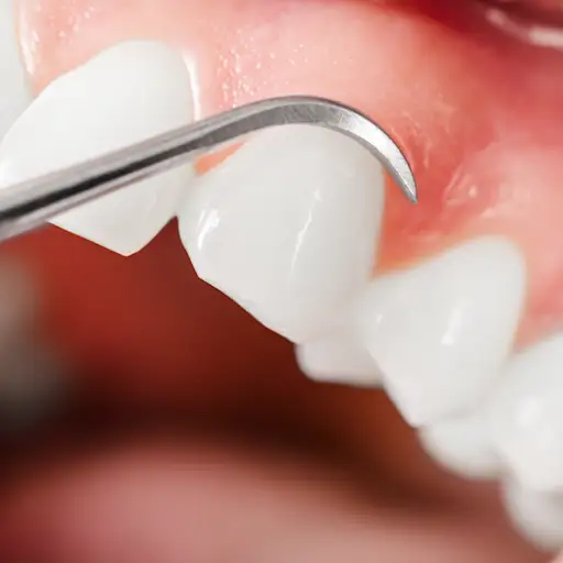 gums