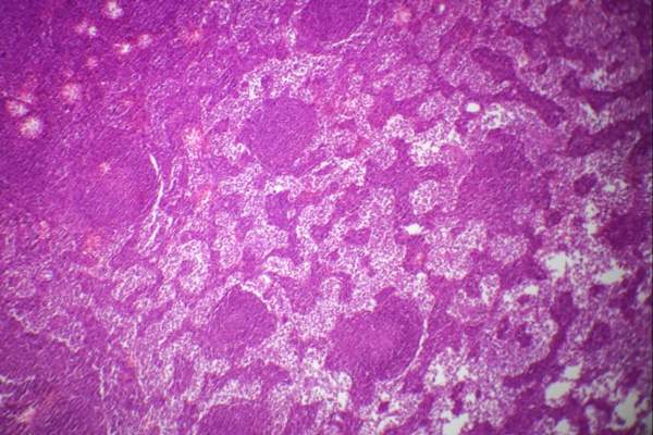 显微镜下淋巴结切片