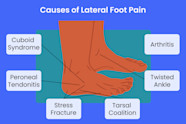 Anatomy Of Foot Pain