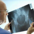 有肺部疾病的女性骨质疏松的风险更高