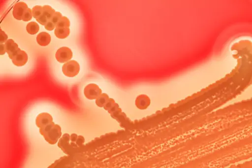 血琼脂平板培养金黄色葡萄球菌菌落。