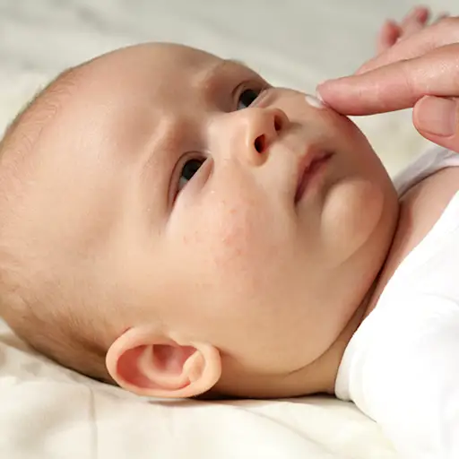 8 Habits That Make Eczema Worse 8 Habits That Make Eczema Worse