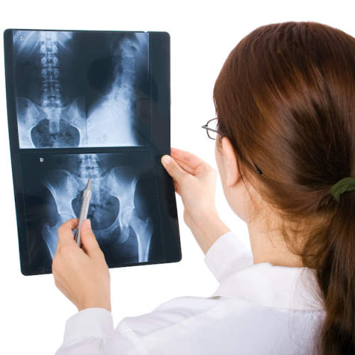 医生检查病人脊柱的X光片。