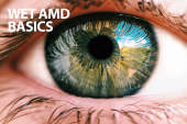 Wet AMD Basics