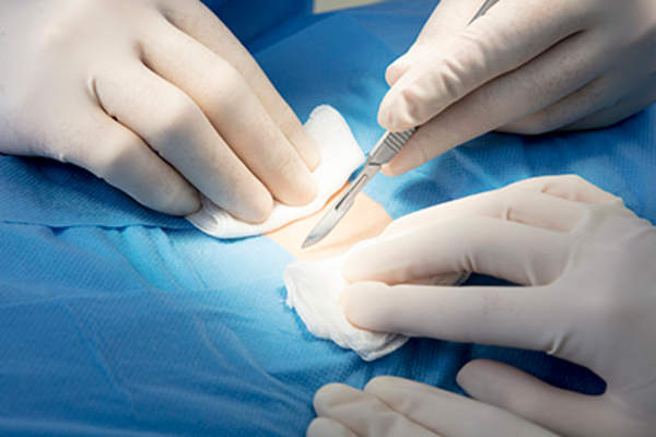 Surgery for Crohn's Disease: Reasons, Complications, and More