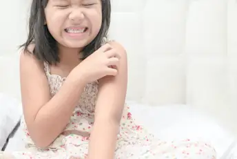 儿童牛皮癣