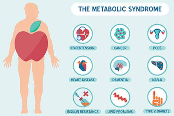 代谢综合征的症状。