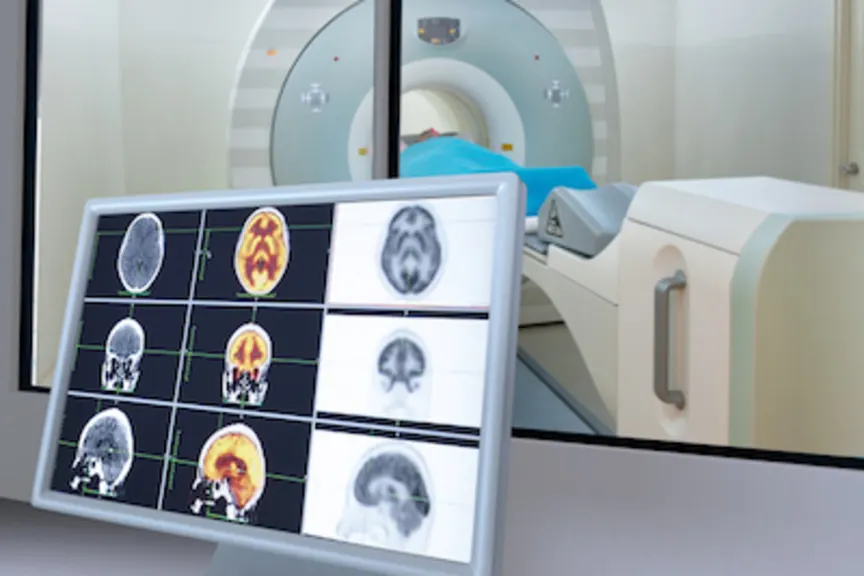 头部和颈部mri