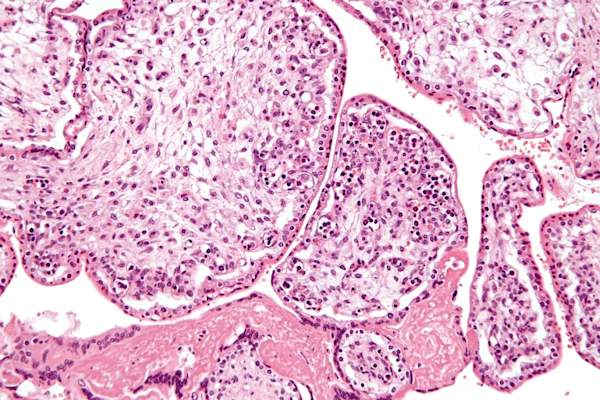 显示细小病毒感染的显微照片