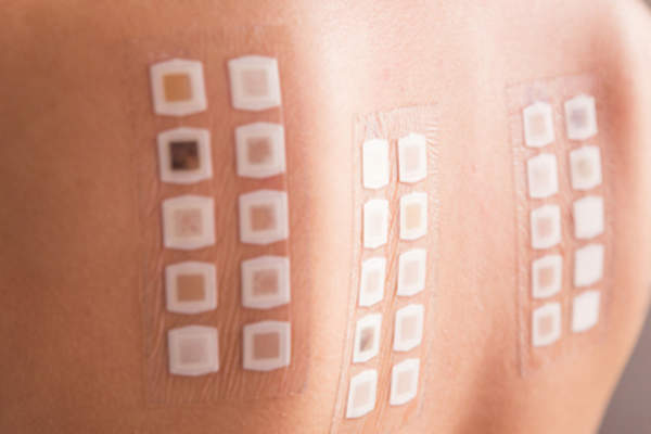 贴片测试,过敏测试。